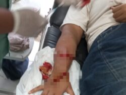 Diduga Korban Begal, Warga Desa Ratu Abung Dilarikan ke Klinik Alami Luka Bacok di Tangan