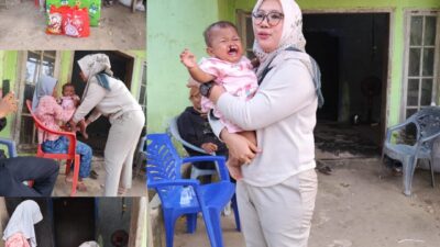 Yayasan Puri Andan Jejama Sambangi Balita Penderita Bibir Sumbing di Sidomulyo